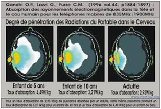 Effet smartphone cerveau